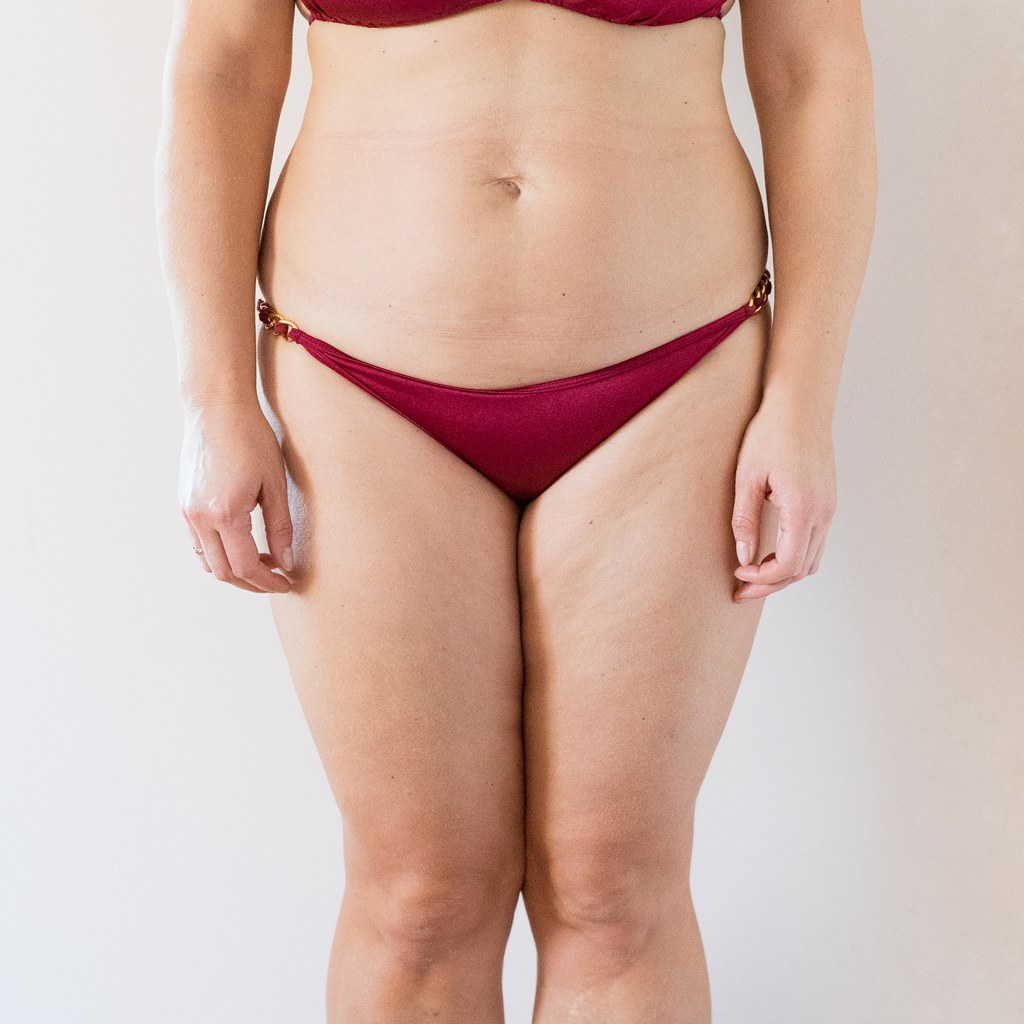 Before and after medical weight loss program at Miracle Wellness — before