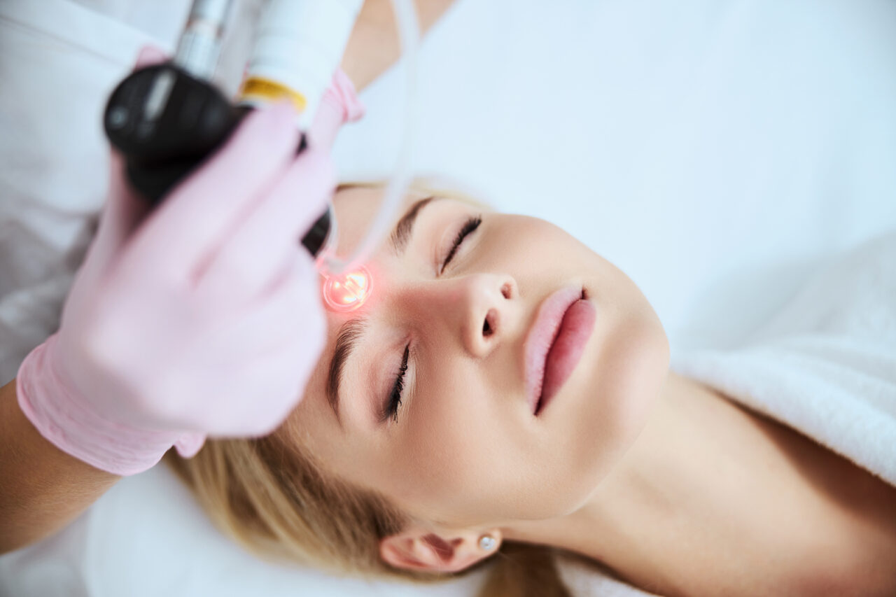 The Power of Candela Laser Treatments: Smooth Radiant Skin Awaits